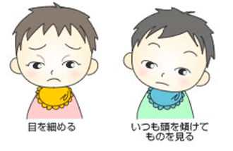 弱視