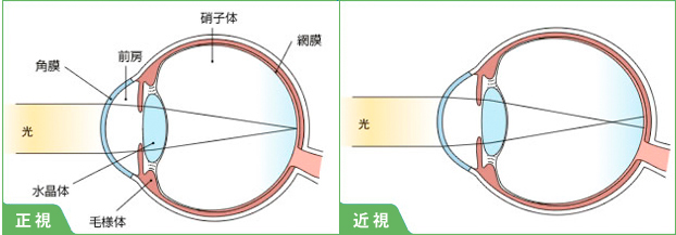 仮性近視外来